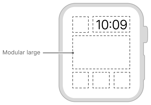 Diagram showing the size and position of a modular large complication.